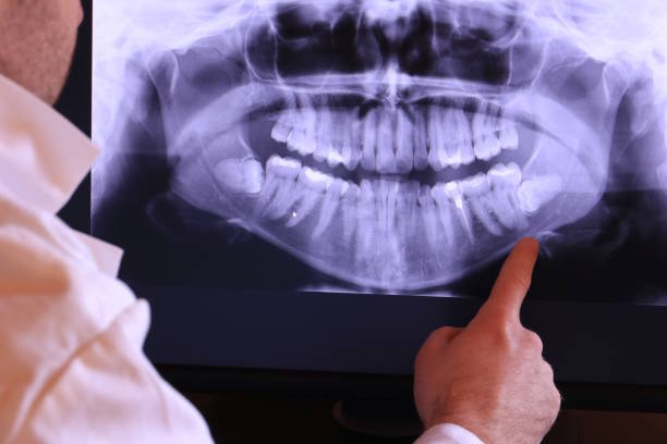 Best Emergency Cosmetic Dentistry (e.g., broken veneers) in Wrightsville, GA