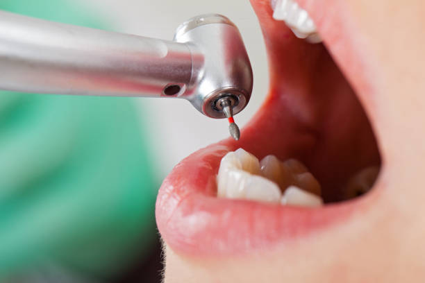 Best Emergency Treatment for Oral Infections in Wrightsville, GA